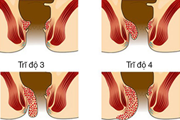 image5-dd